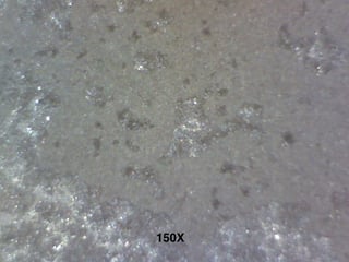 Anodizing Issues Cast Aluminum _150X.jpg